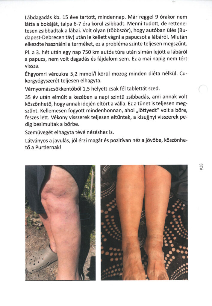 Cukorbetegség