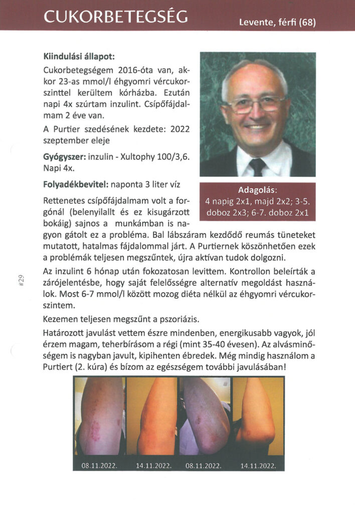 Cukorbetegség