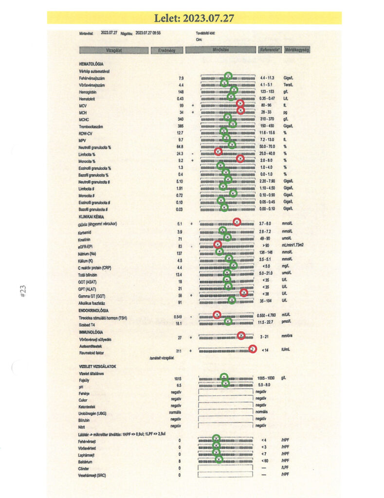 Rheumatoid arthritis